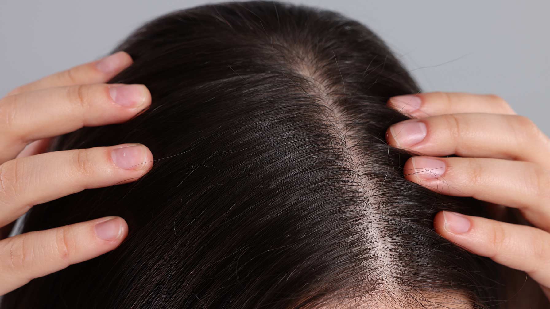 Microbiota do couro cabeludo: importância e cuidados com a raiz